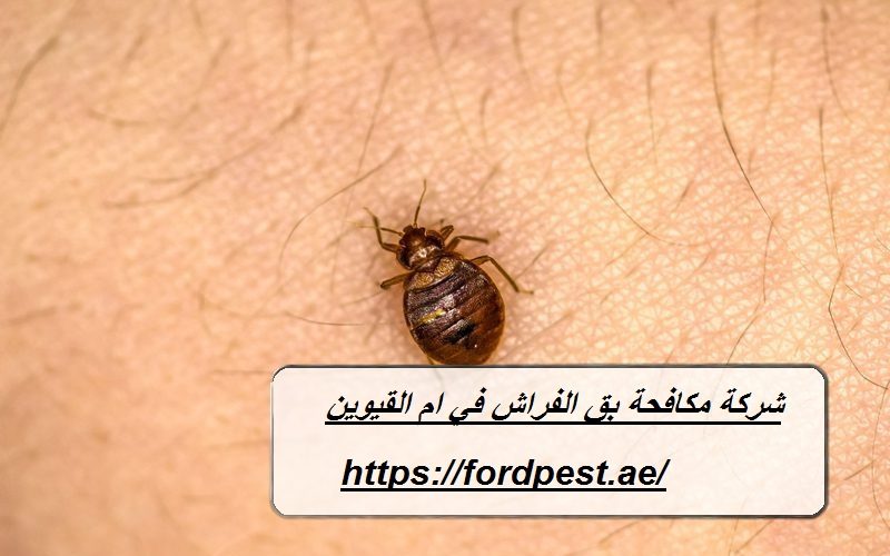 شركة مكافحة بق الفراش في ام القيوين